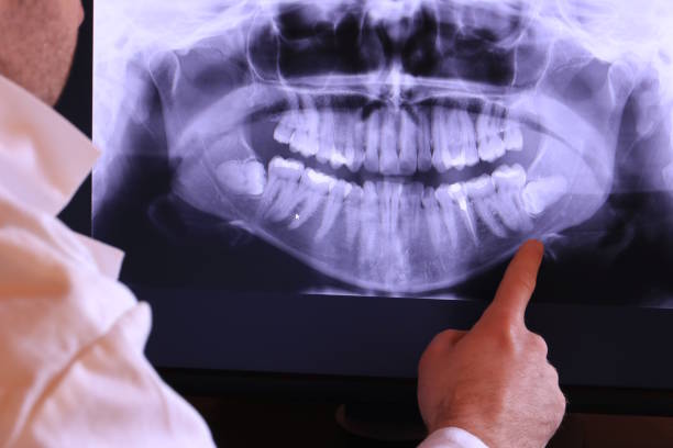 Best Emergency TMJ Treatment in Lone Jack, MO