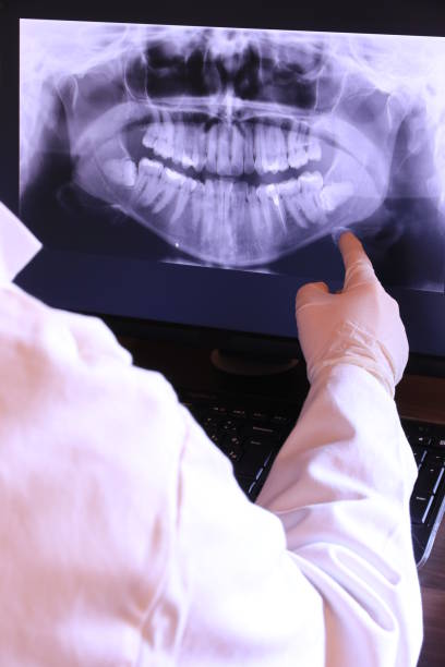 Best Emergency Tooth Extraction in Lone Jack, MO