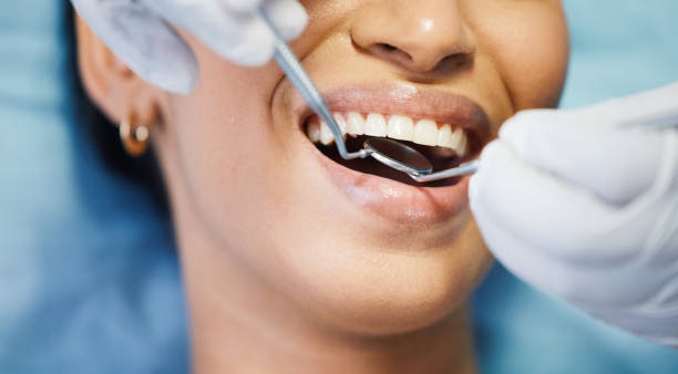 Best Emergency Root Canal Treatment in Lone Jack, MO